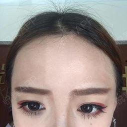 祛眼袋视频,祛眼袋视频全解析