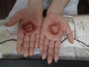 拍手功视频,轻松入门的养生拍手法